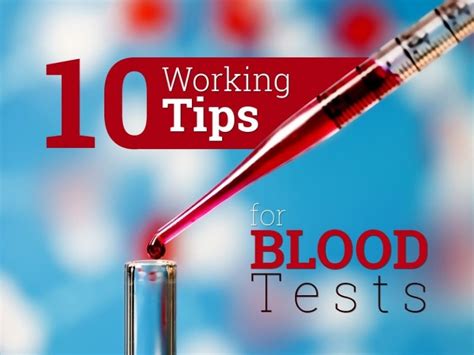 10 Working Tips For Blood Tests