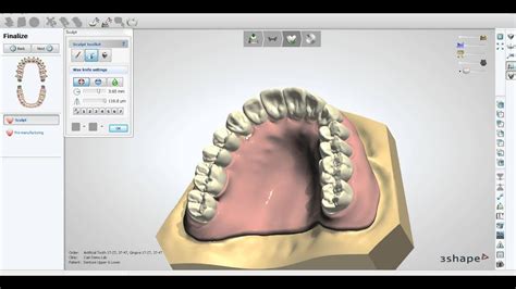 3Shape Denture Designs Upper Lower Dentures Youtube