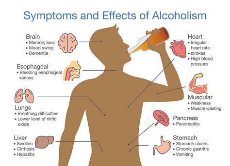 Alcoholism Symptoms Causes Effects And Treatments