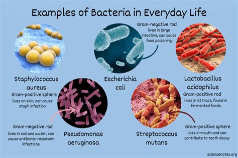 Can Bacteria Survive In Vacuum At Jimmy Richards Blog