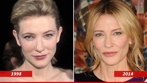 Cate Blanchett Good Genes Or Good Docs