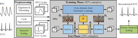 Cross Domain Joint Dictionary Learning For Ecg Inference From Ppg