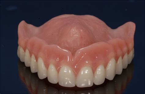 Dental Labs For Dentures In Arizona Conventional Full And Partial