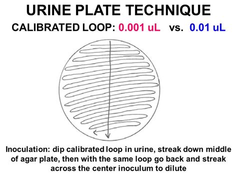 Disadvantage Of Streak Plate Technique What Are The Drawbacks Of The