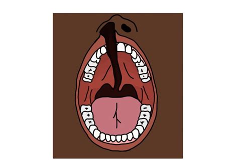 English Cleft Palate Speech Therapy Evaluation And Treatment Asha 0 5 Ceu Self Study Course