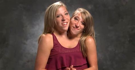 Exploring The Lives Of Conjoined Twins Abby And Brittany A Journey Of Unbreakable Bond And