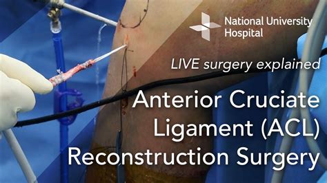 Fmla For Acl Surgery