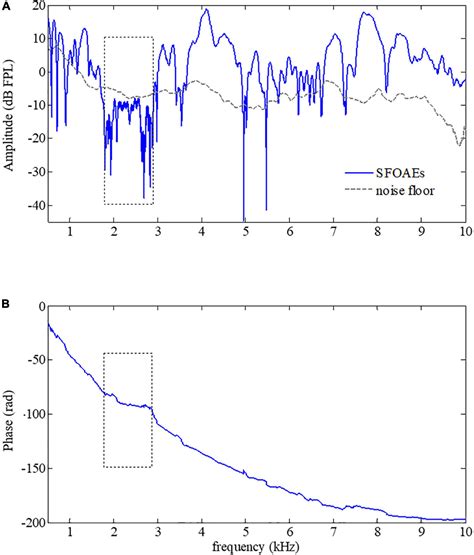 Frontiers Usefulness Of Phase Gradients Of Otoacoustic Emissions In Auditory Health Screening