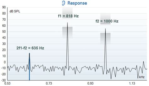 Otoacoustic Emissions Oaes A Complete Guide Interacoustics