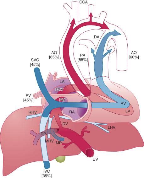 Paediatric Anaesthesia Clinical Tree