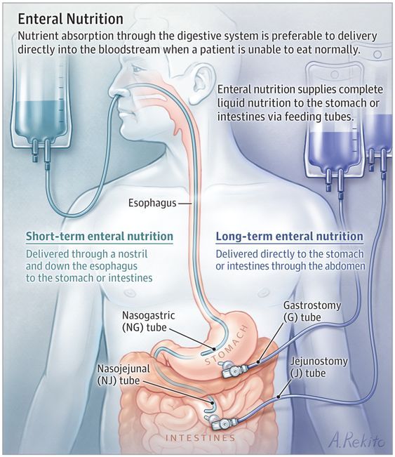 Pin On Nursing Stuff