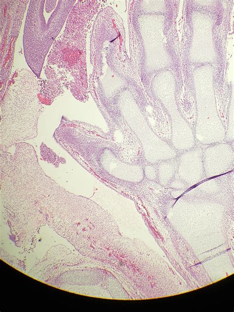 Query Product Of Conception R Pathology