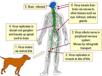 Rabies Infectious Dis Medbullets Step 2 3