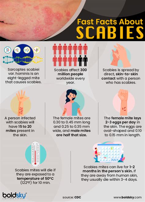 Scabies Symptoms Pictures And Diagnosis