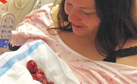 Stunning Photo Of Noah Miscarried At 12 Weeks Shows Life In The Womb Bristol Palin