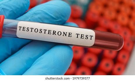 Testosterone Hormone Test Result Blood Sample Stock Photo Edit Now