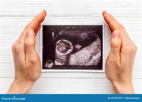 Ultrasound Picture Of Unborn Baby Pregnancy Concept Stock Image