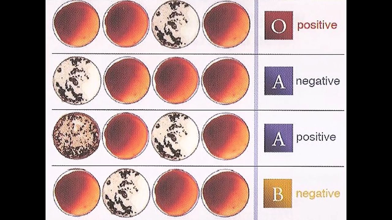 Understanding Blood Type Results Review And Practice Youtube