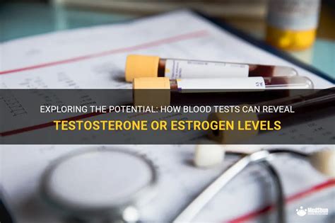 What Blood Tests Are Used To Determine Your Testosterone Levels