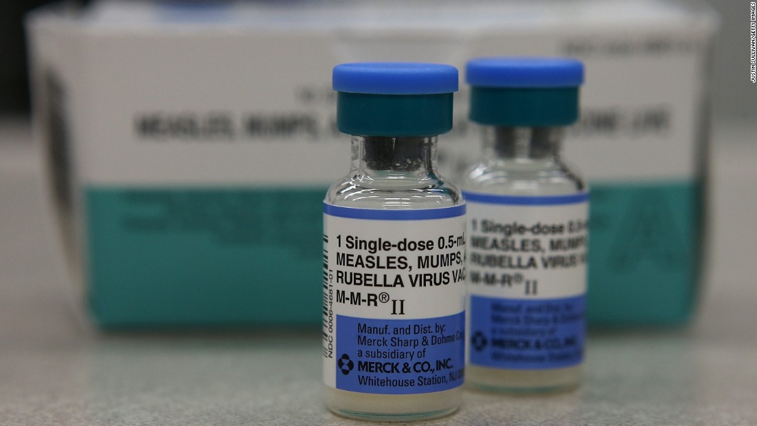 Mumps Vaccine Name